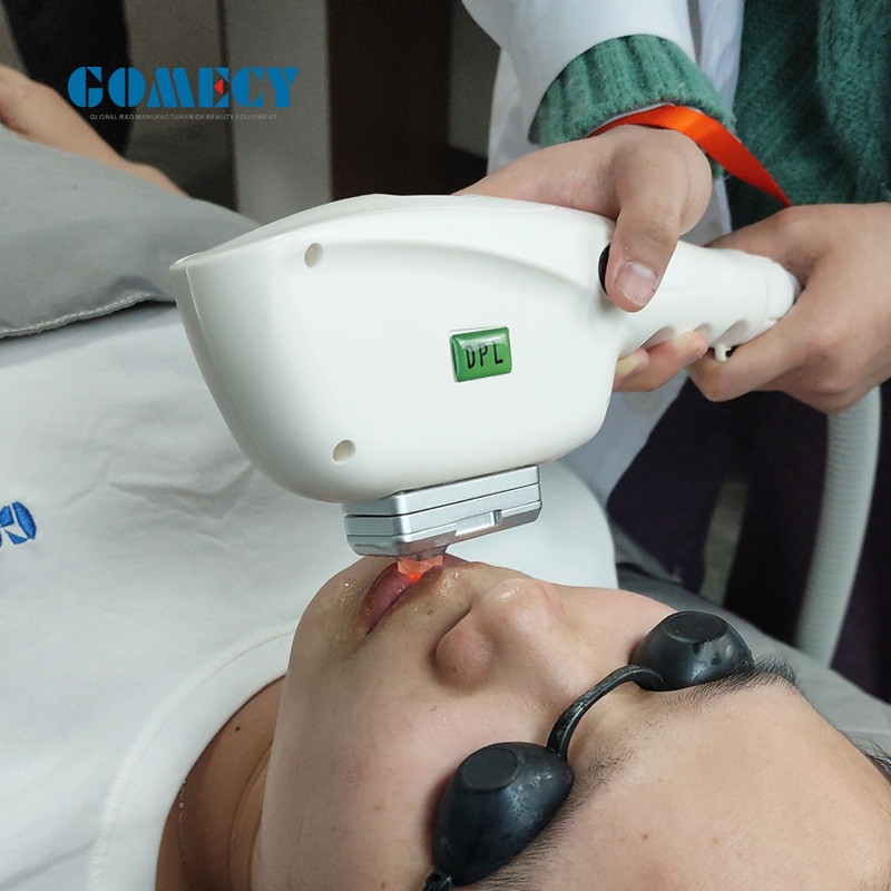 Advanced IPL SHR Elight Machine for Skin Rejuvenation Energy 10-50J/cm2 IPL Frequency 1-10Hz