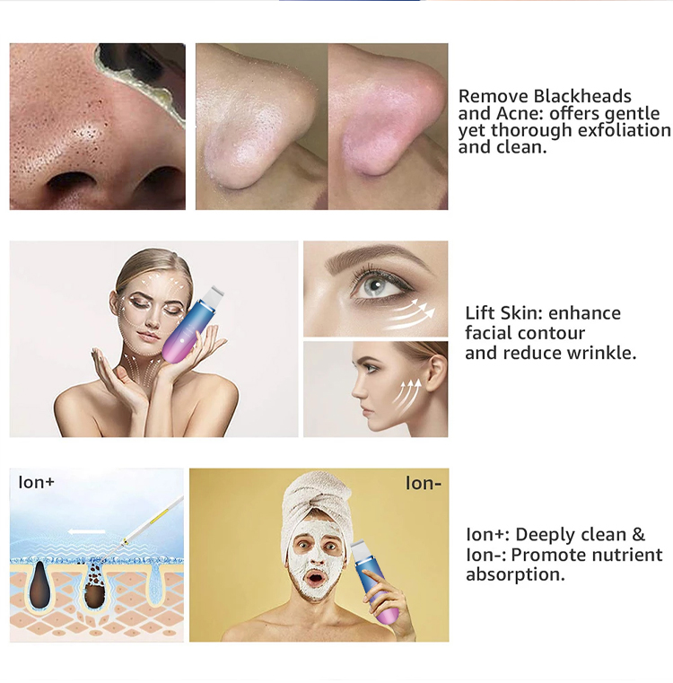 Microdermabrasion Ion Blackhead Remover Scrubber Portable Ultrasonic Cleaner