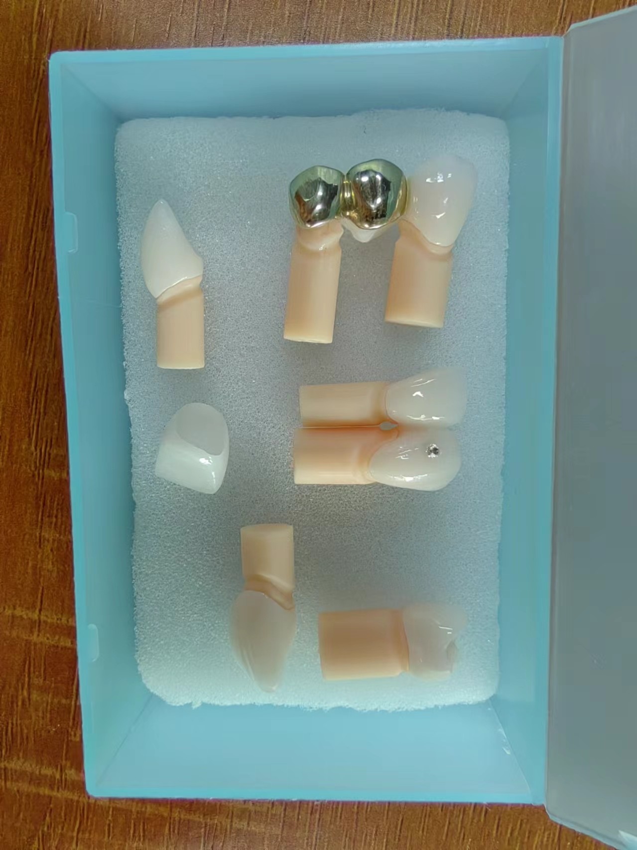 Highly Translucent Zirconia Crowns Bridge Veneers With Customized Jewelry And Gold Beautiful Dental Restoration Case