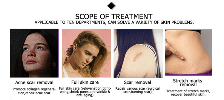 10600nm lumenis ultrapulse co2 laser machine for skin resurfacing