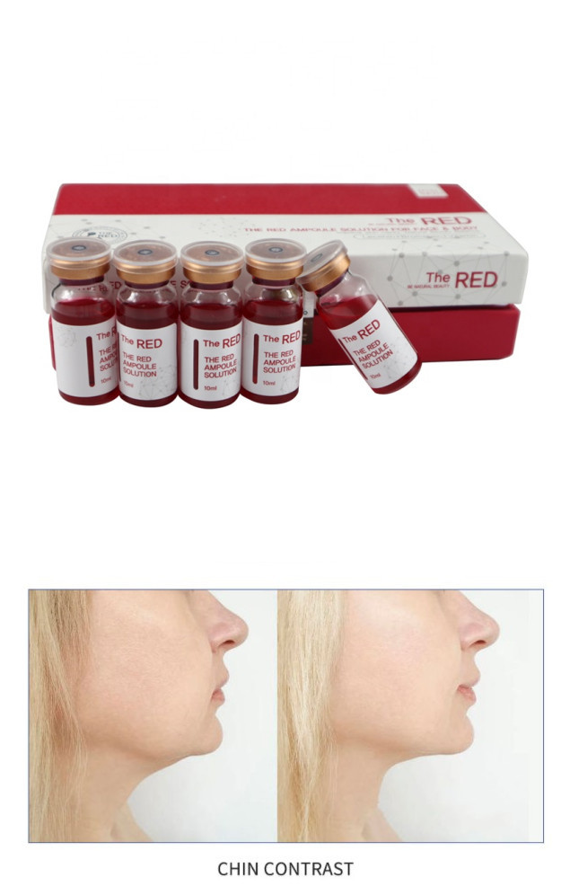 Phosphatidylcholine Ppc Injection Lipolysis Solution Fat Dissolve