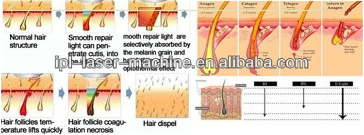 3 in1 laser elight ipl rf cavitation machine for hair removal wrinkle removal