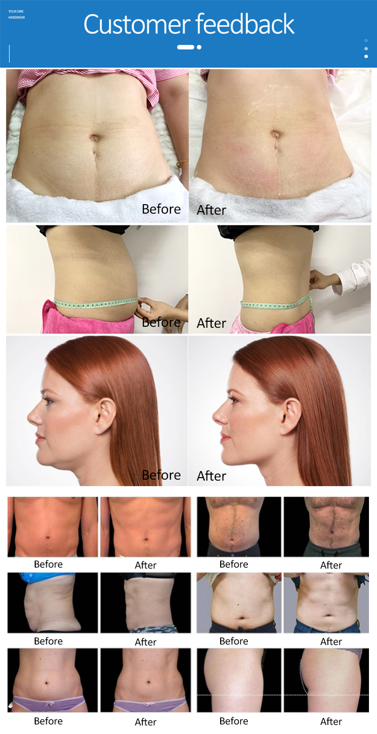 360 cellulite professional aesthetic machine productos de belleza beauty salon estetica equipment