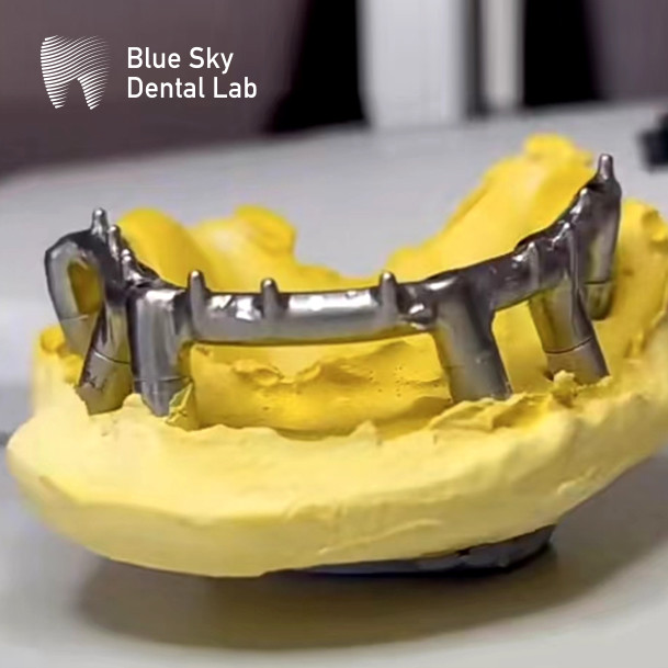 Blue Sky Dental Implants Silver Titanium Bar For Dental Implants