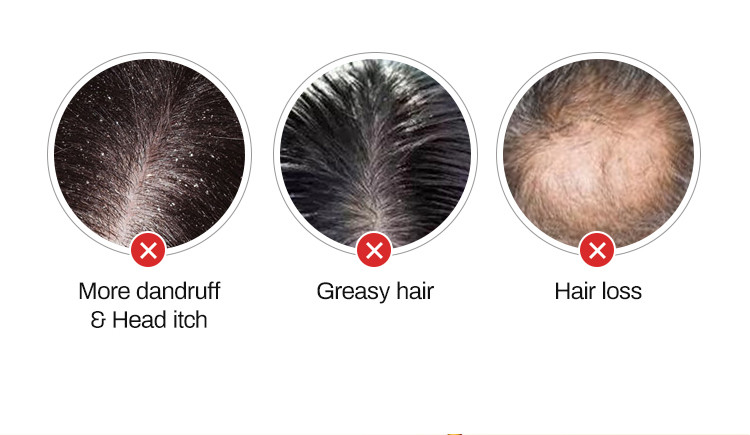 Best Selling Hair Growth Shampoo for Thinning Hair Loss for Women and Men Thicker Longer Hair