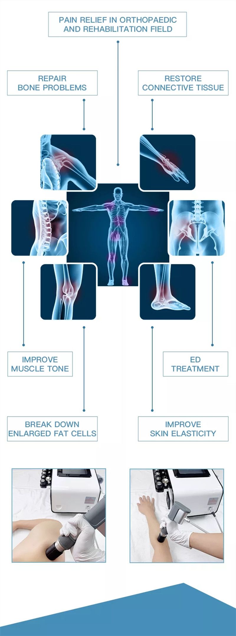 ESWT Phyiso Radial Shockwave Therapy Machine 200mj Energy 16Hz Frequency For Panin Relief