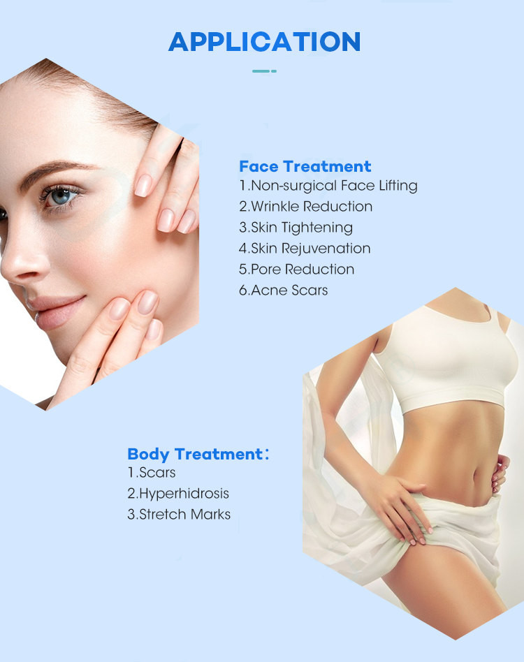10MHz To 12 MHz Microneedling Machine Scar Stretch Marks Acne Wrinkle Removal