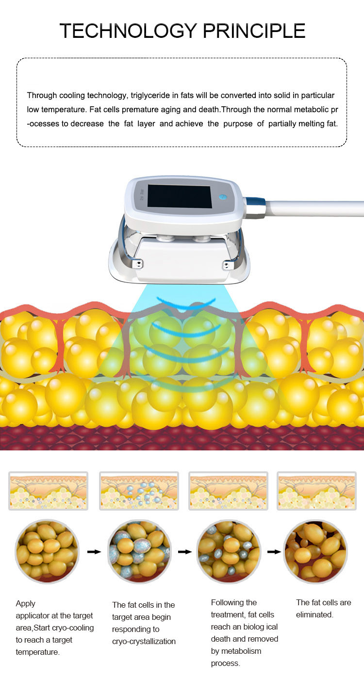CE approved criolipolisis cool tech cryolipolysie 5 cryo handles simultaneously cryolipolysis body contouring machine