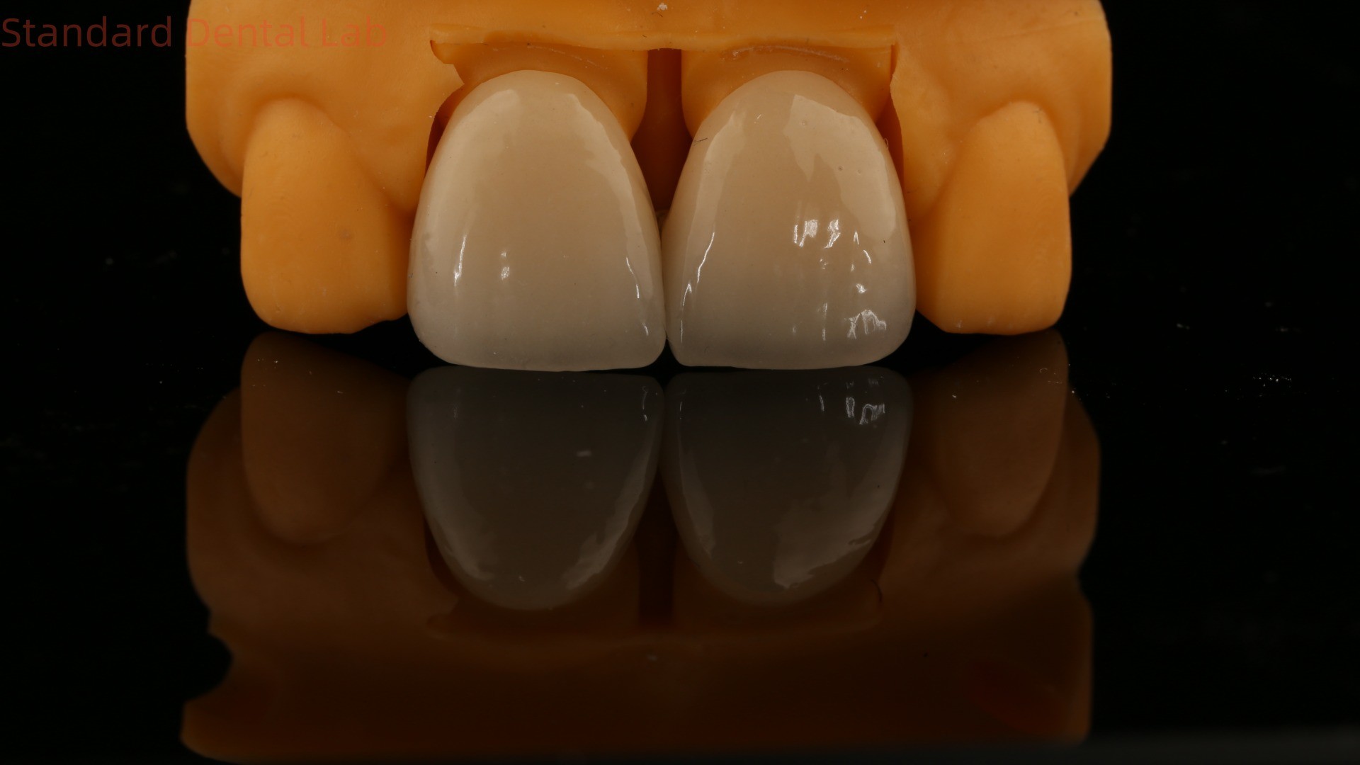 5 Year Guarantee Full Contour Zirconia Crown Customized Vita Shade High Aesthetic Natural Dental Bridge