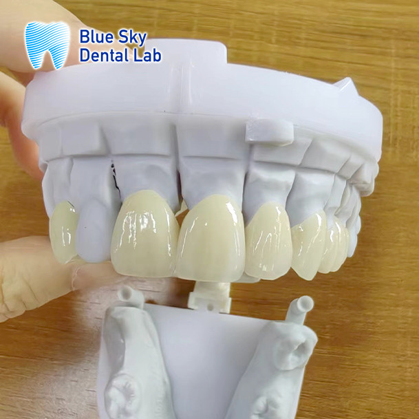 Natural Esthetics Multi Layered Zirconia Crown High Strength Chemical Resistance