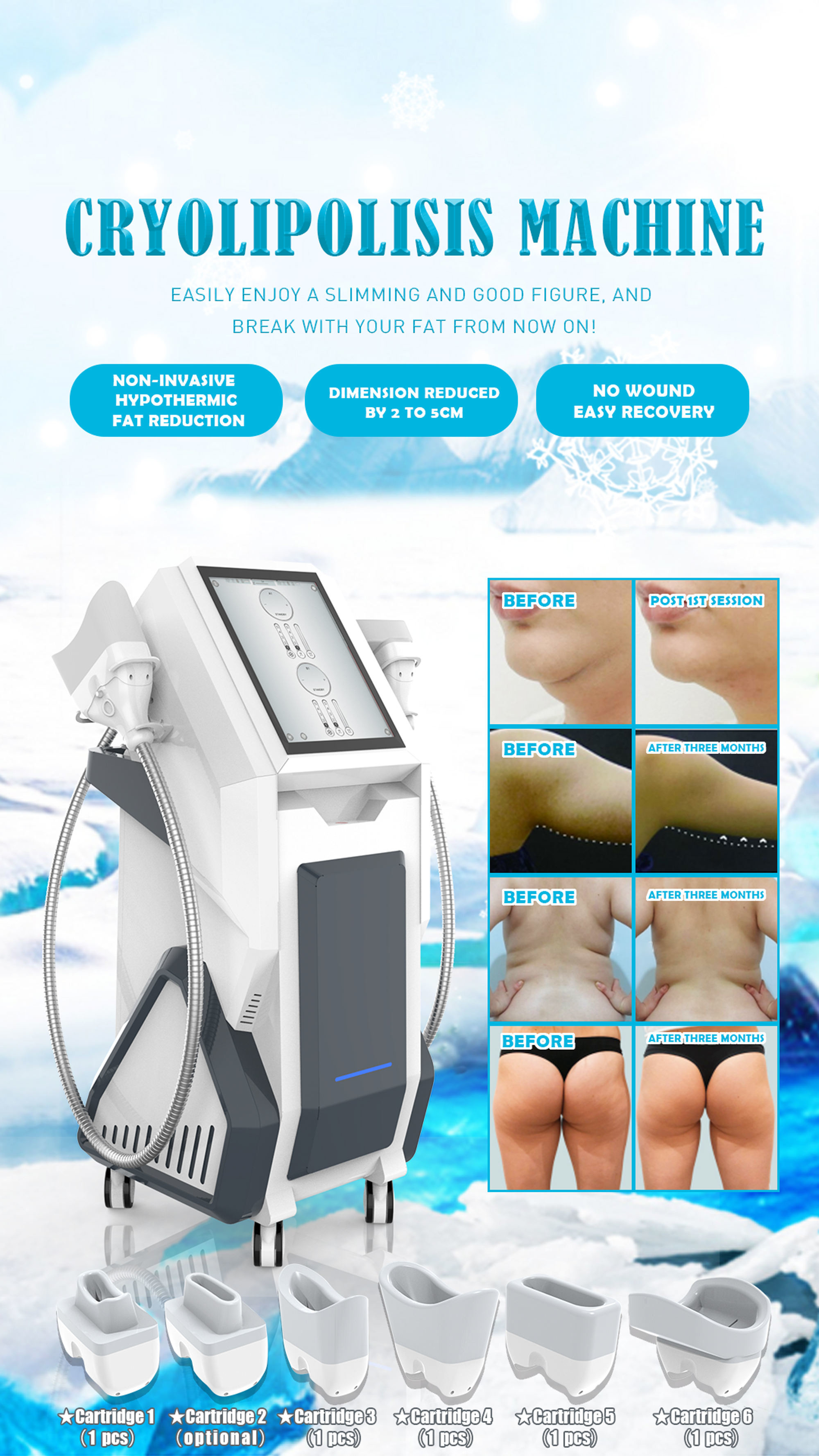 RF 360 Cryolipolysis Slimming Machine Non Invasive Cavitation ISO90 Approval