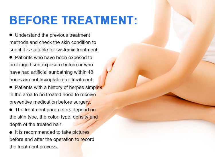 Portable 808nm Diode Laser Hair Removal Machine For Home