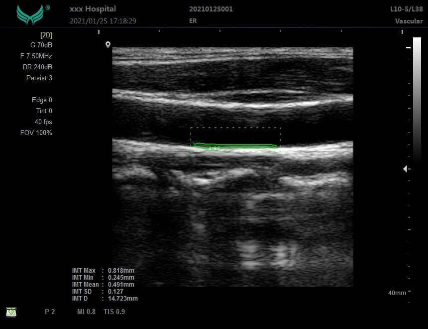 OEM Hospital Ultrasonic Diagnostic Instrument 120GB Ultrasound Medical Equipment