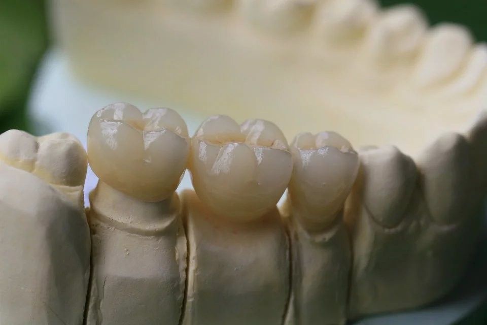Dental Lab Porcelain Zirconia Dental Crown 5 Stars Esthetics