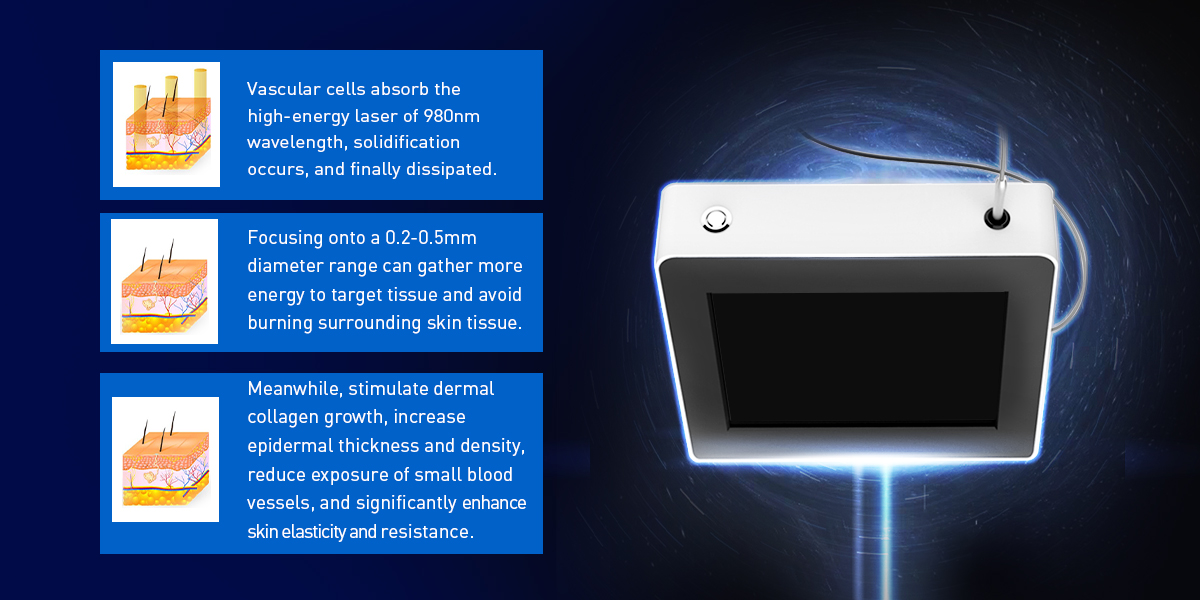 Professional 30W Spider Vein Removal 980nm Diode Laser Vascular Laser Machine Diode Laser 980nm