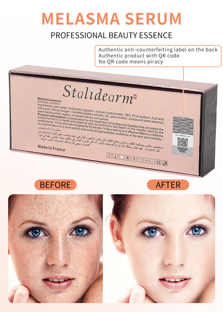 Private Label Stalidearm Melasma Freckle Skin Whitening Serum Corrector Black Dark Spot Remover Face Essence
