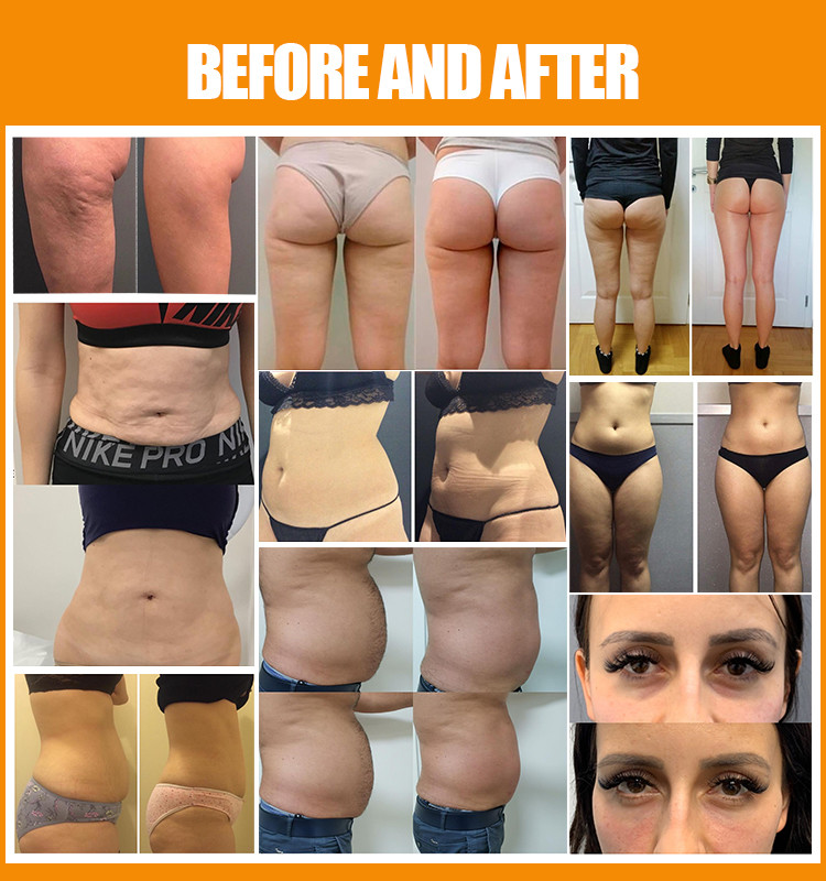 Vertical Slimming Machine 7 In 1 Weight Loss Cellulite Treatment Device