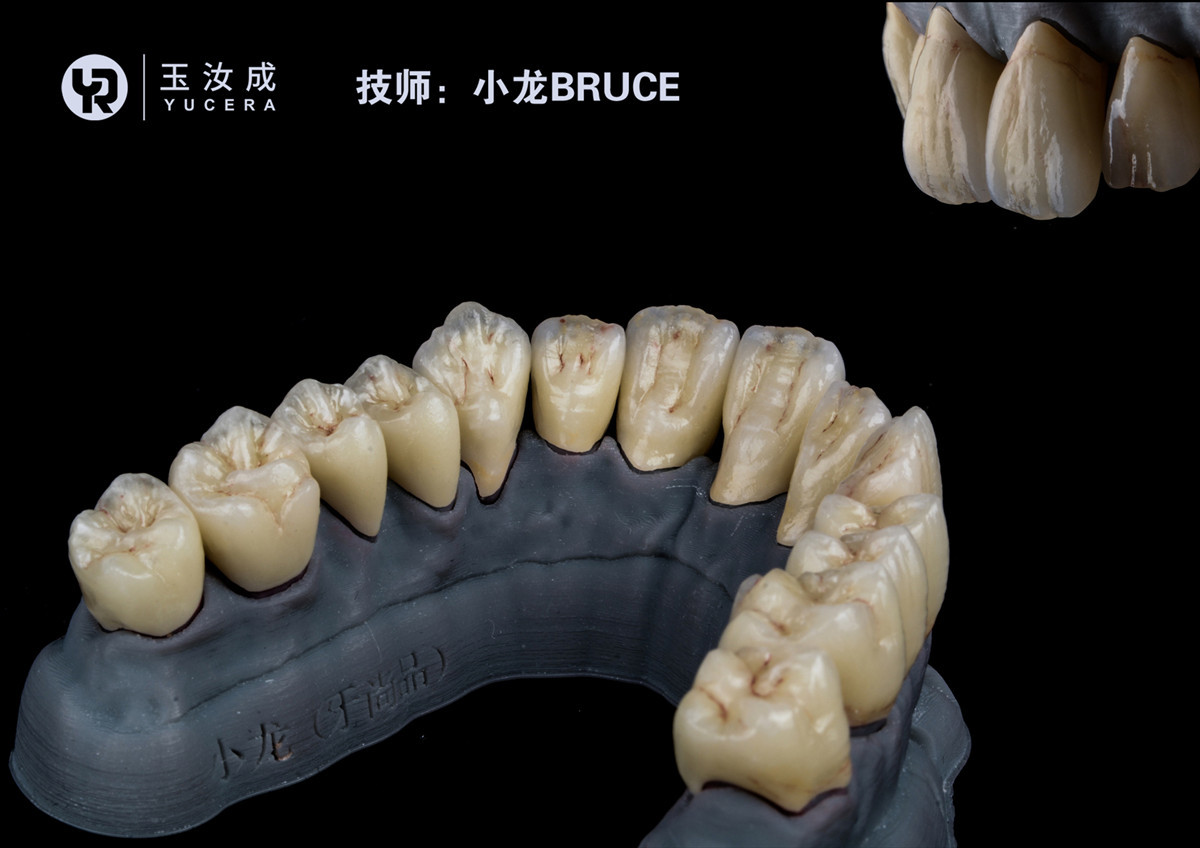 ST Color Pre Shaded Zirconia Blocks Dental CAD CAM System Dental Zirconia Ceramic Blocks