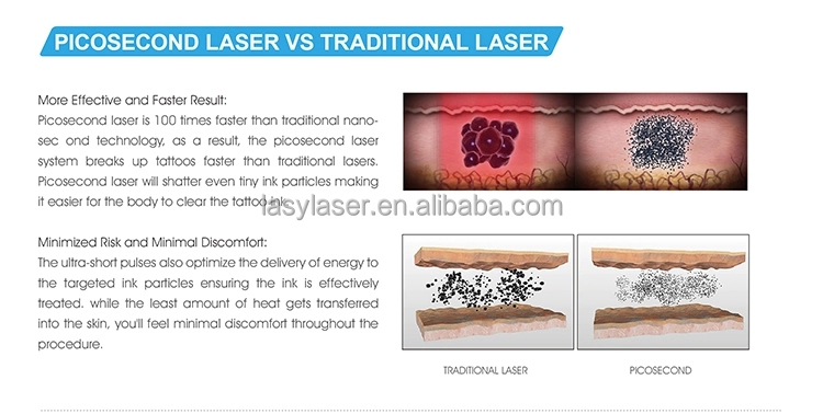 755nm 532nm picolaser Laser Tattoo Removal Machine 1064nm Microdermabrasion Device