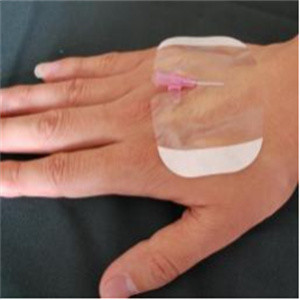 ISO13485 Adhesive Transparent Island Dressing Waterproof Wearproof