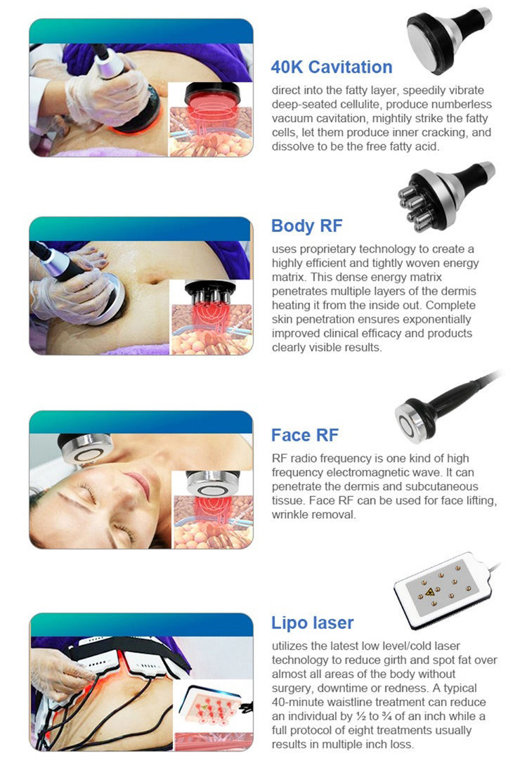 RF 360 Cryolipolysis Slimming Machine 800W Cryo Slim Shaper