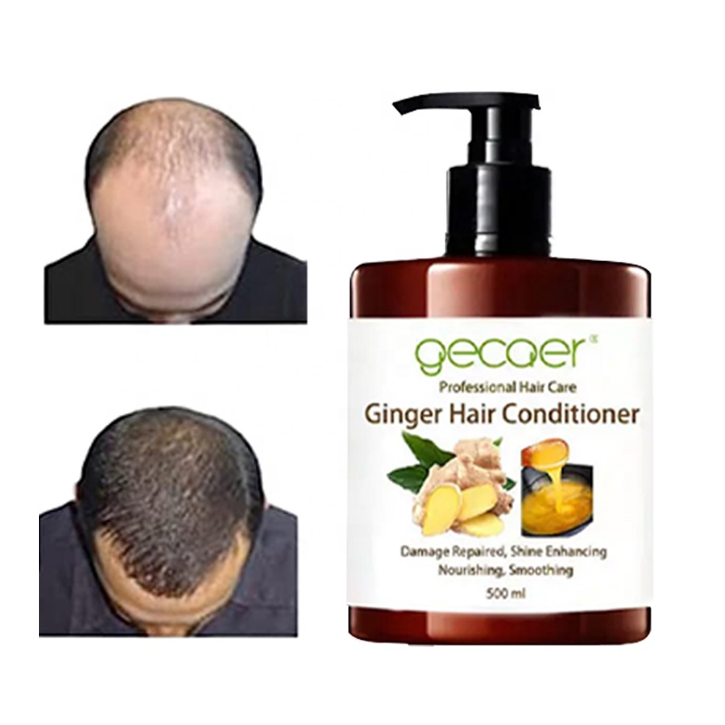 All Hair Types Anti-hair Loss Organic Hair Care Set with Ginger Shampoo and Conditioner