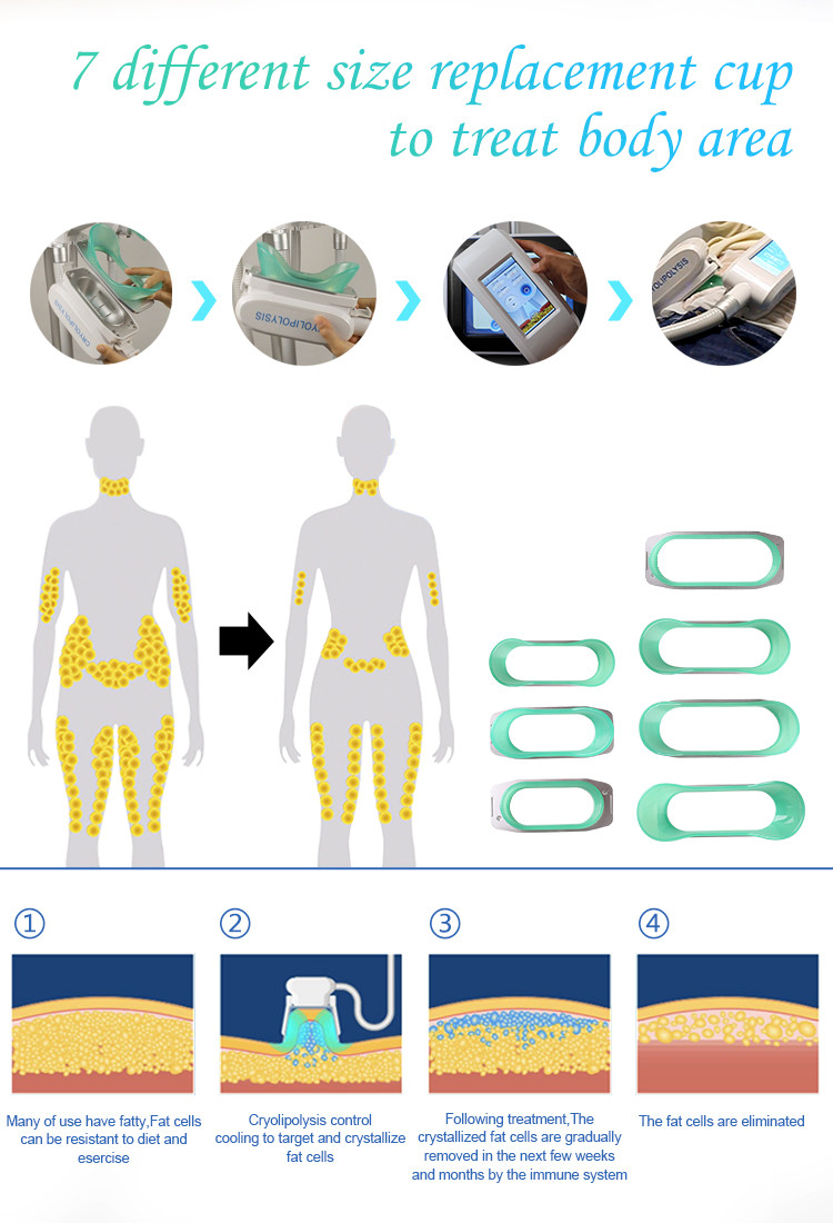 Cryo Reduction Device For Body Reshape With ≤80% Relative Humidity