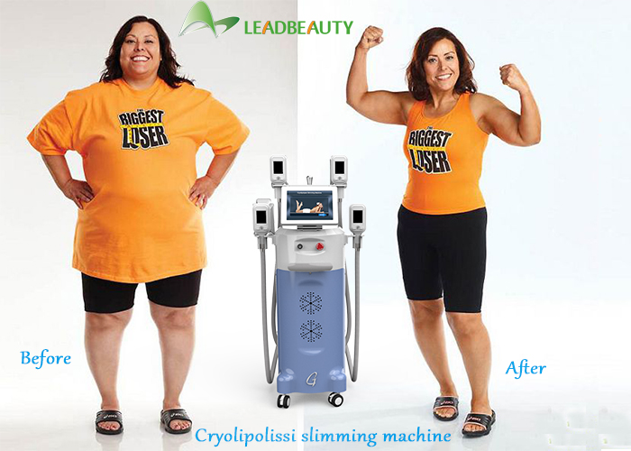 Coolplas Cryolipolysis slimming machine/Cryolipolysis machine for spa use