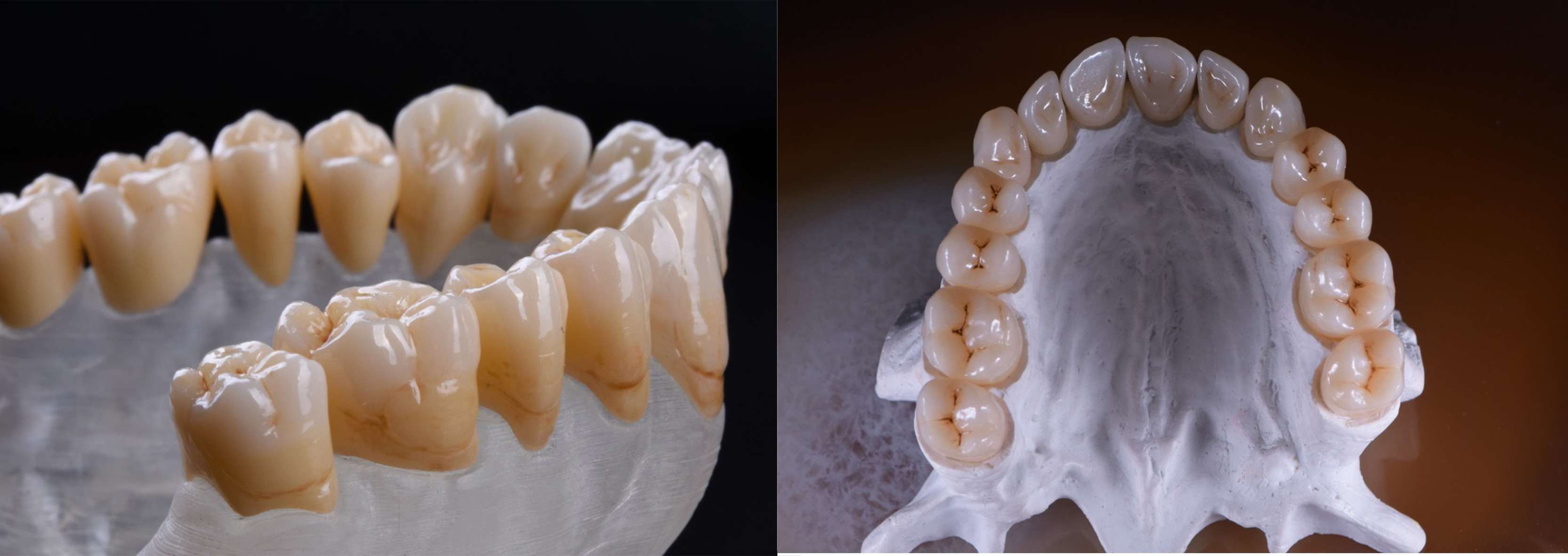 6.07g/Cm³ Dental Zirconia Block