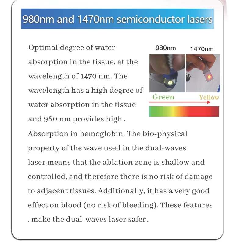 980nm 1470nm Diode Laser Gynecology Vaginal Tightening Surgery Laser