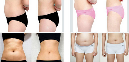 2016 Sanhe Beauty cavitation rf HIFU focused ultrasound euipment cavitation rf for body slimming with CE approved
