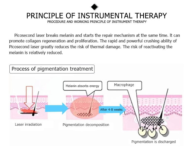 cool system stable 750ps pico Picolaser nd yag pigment and picosecond tattoo removal laser