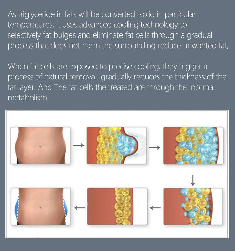 Cryolipolysis Machine Fat Freeze Slimming Cryo Fat Removal With 4 Handles